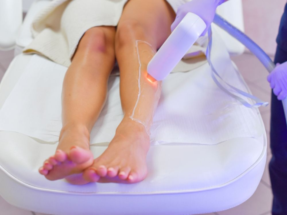 Epilare laser pe picioare într-un salon medical